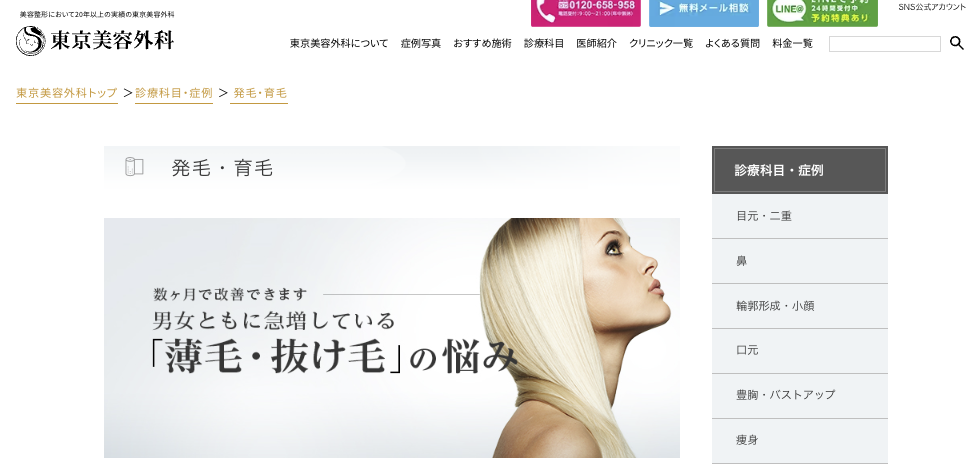 東京美容外科AGA治療