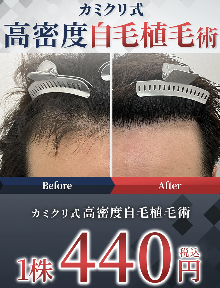 カミノクリニック新LP