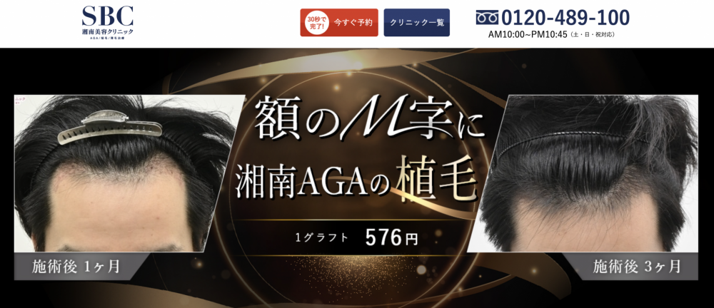 湘南AGAクリニック自毛植毛LP